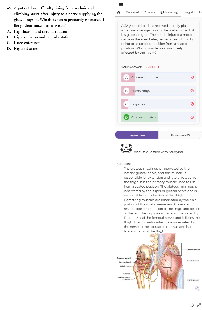 45.png